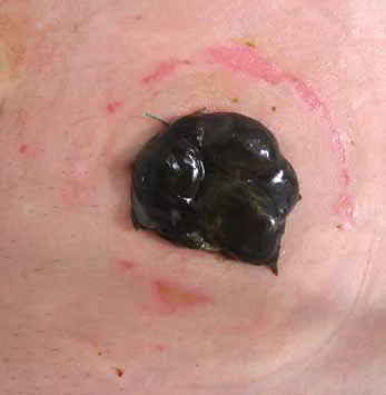 ピンクの表面に黒い塊