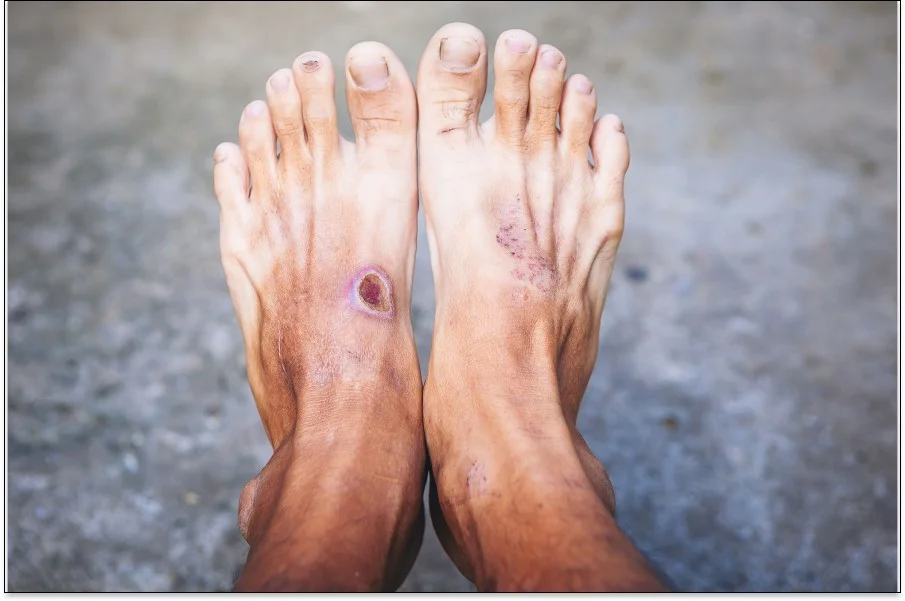 a pair of feet with painted toenails