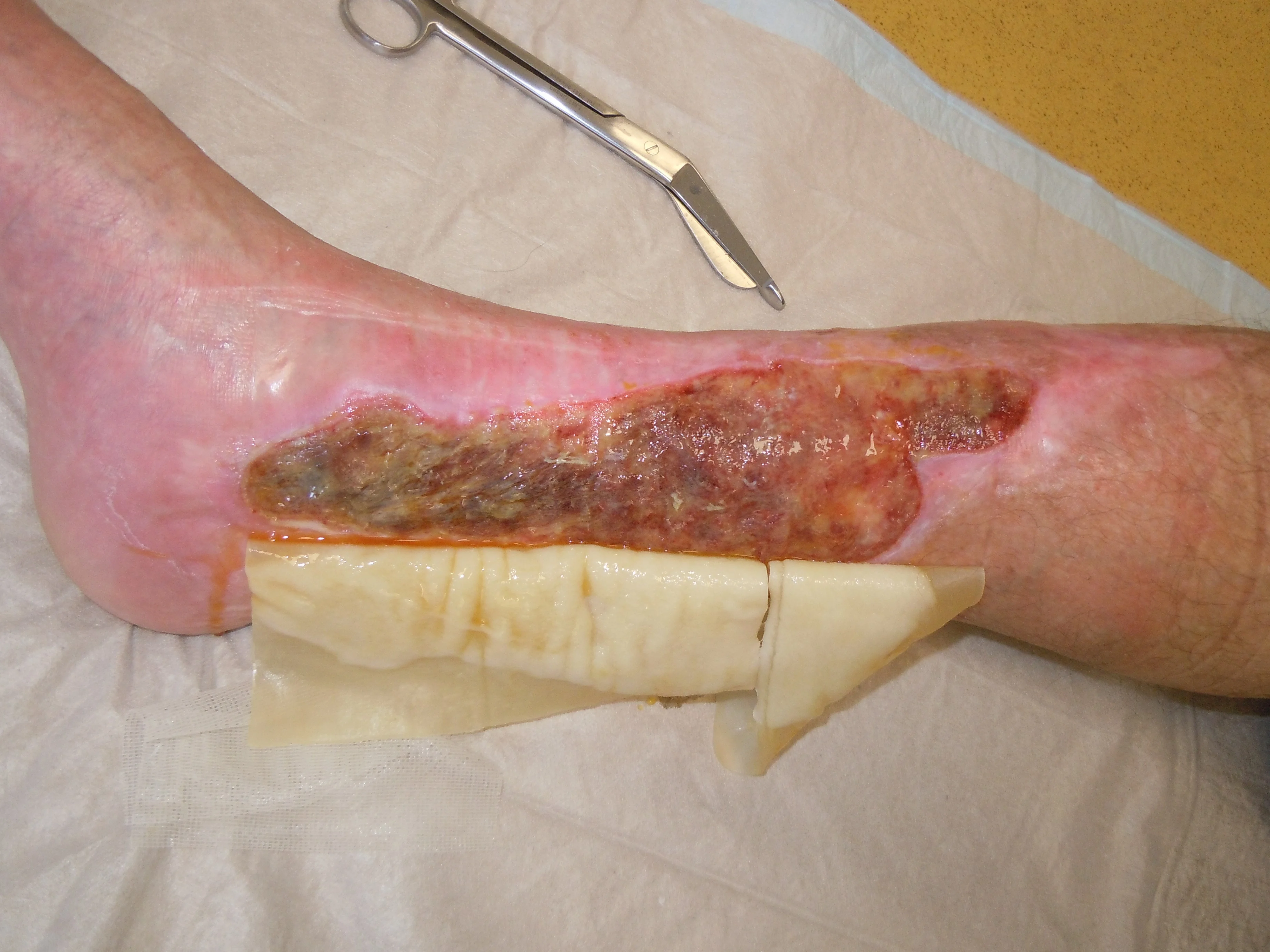 Artikel II - Björn Jäger