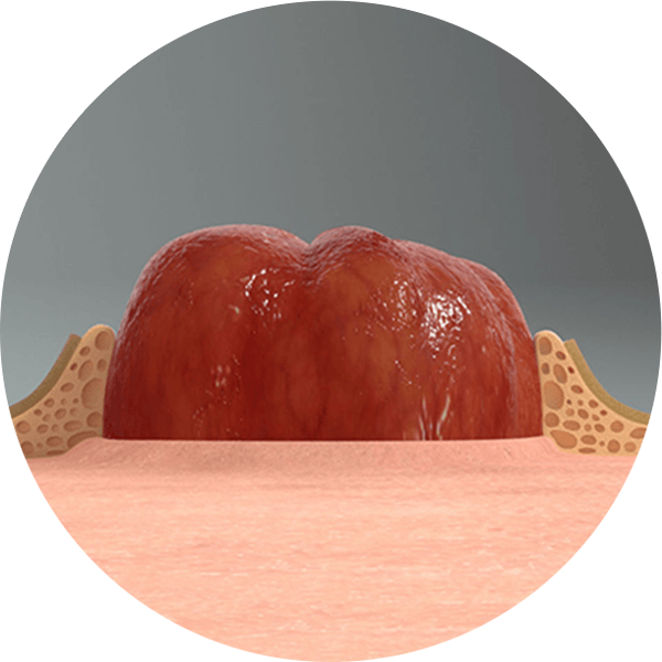 detailný záber systému LEAK-LOCK™